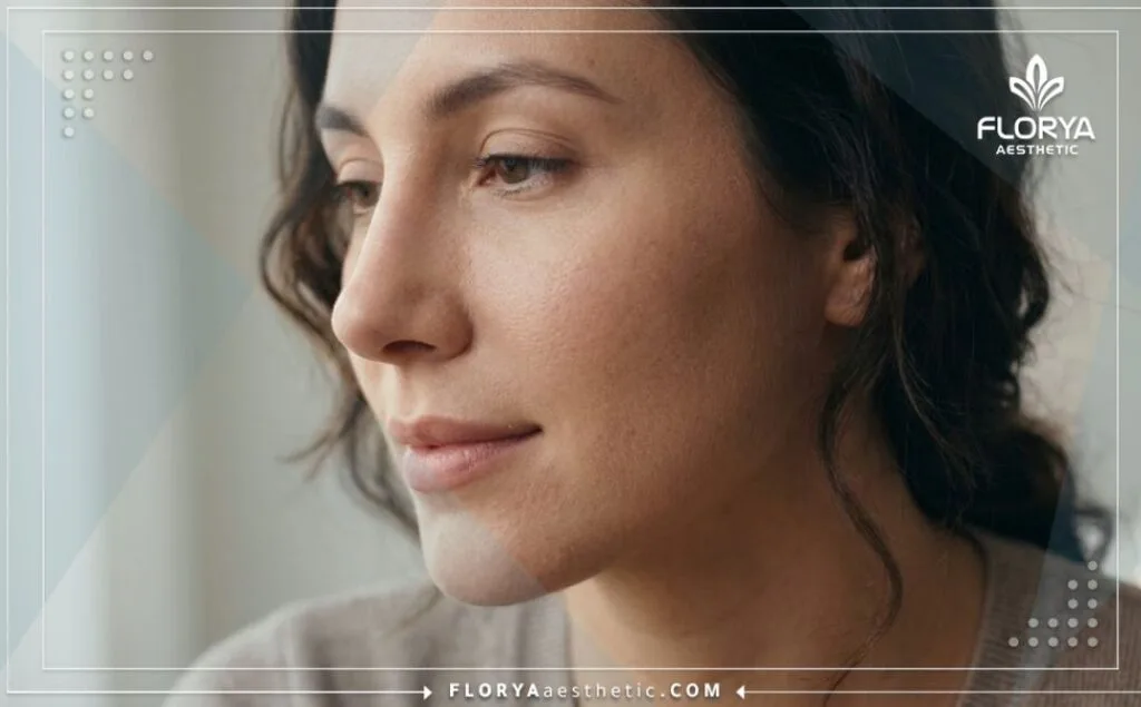 نتيجة مثالية وطبيعية لعملية تجميل الأنف من مسافة قريبة