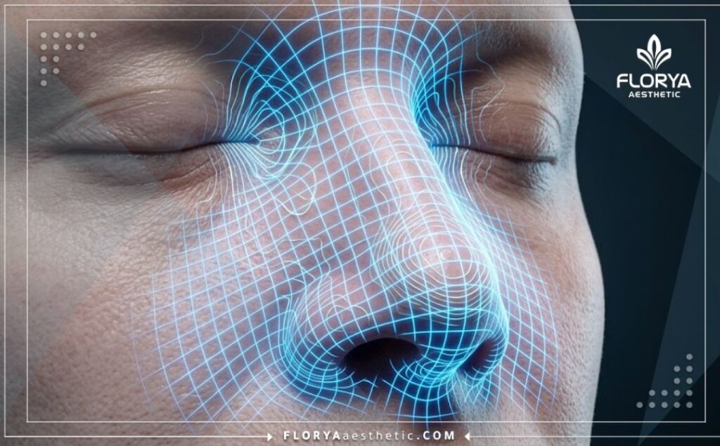 مسح ثلاثي الأبعاد عالي الدقة لمنطقة الأنف يوضح تفاصيل الإجراء الطبي بدقة.